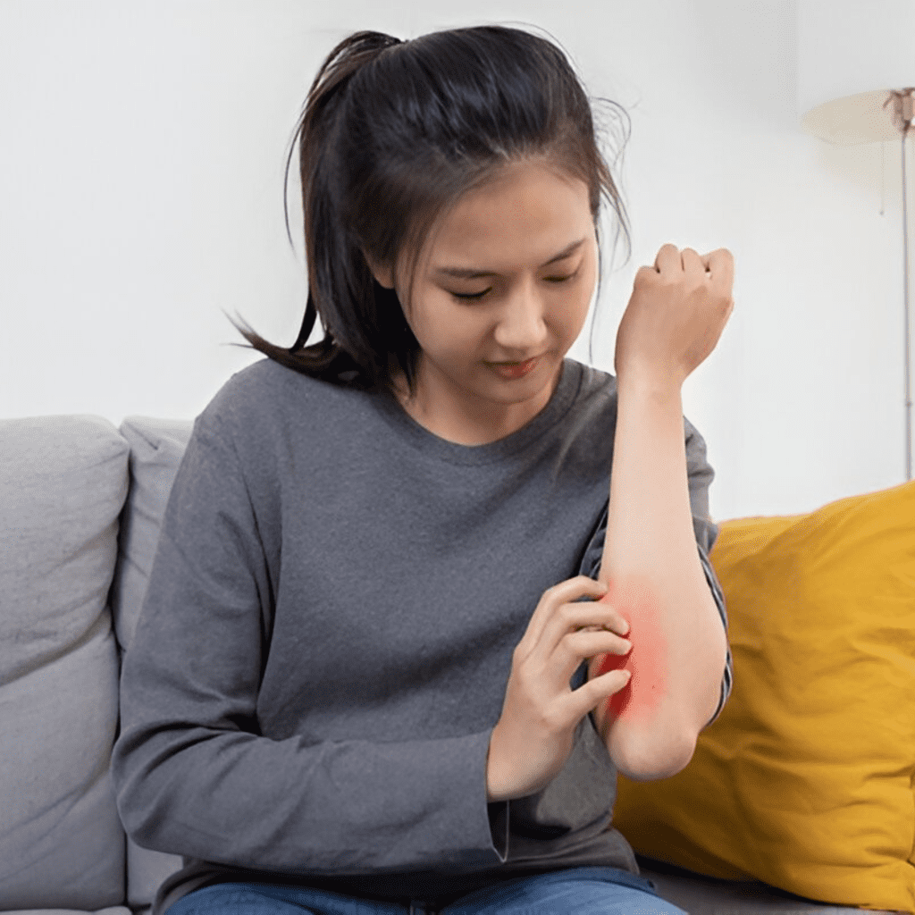 Allergy Test Skin Health Sunsuria Medical - Affordable Clinic for Health Screening & X-ray in Sepang, Nilai