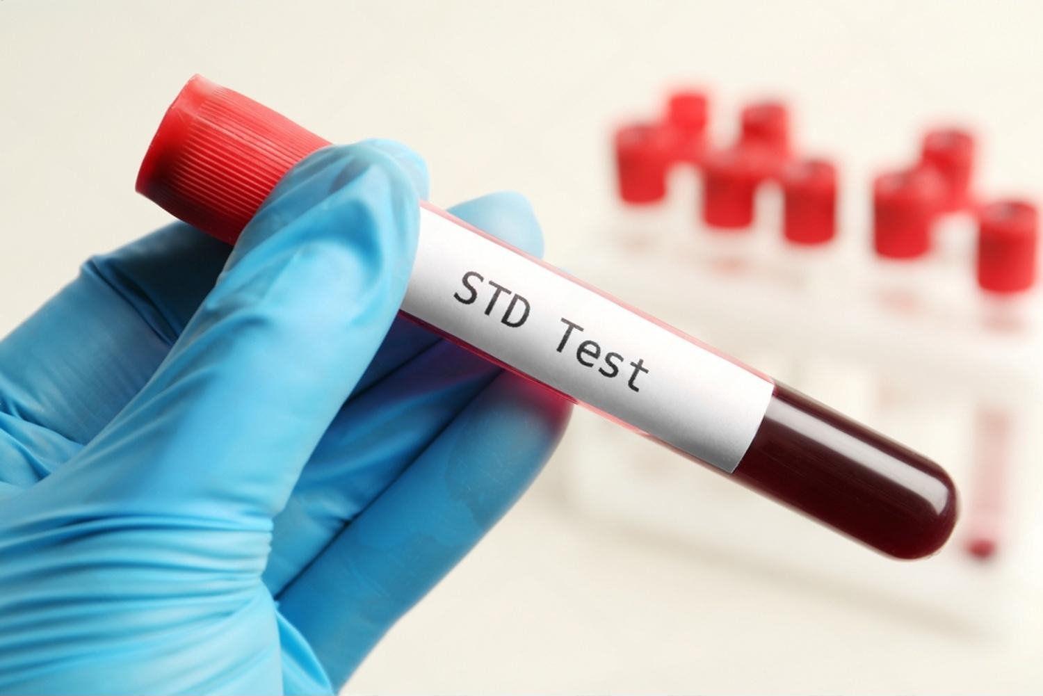 STD Testing Packages Sunsuria Medical Clinic - Affordable Clinic for Health Screening & X-ray in Sepang, Nilai